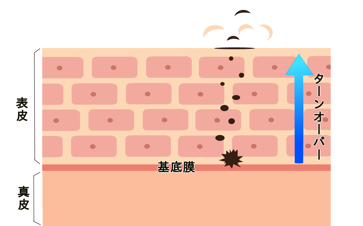 シミのイメージ