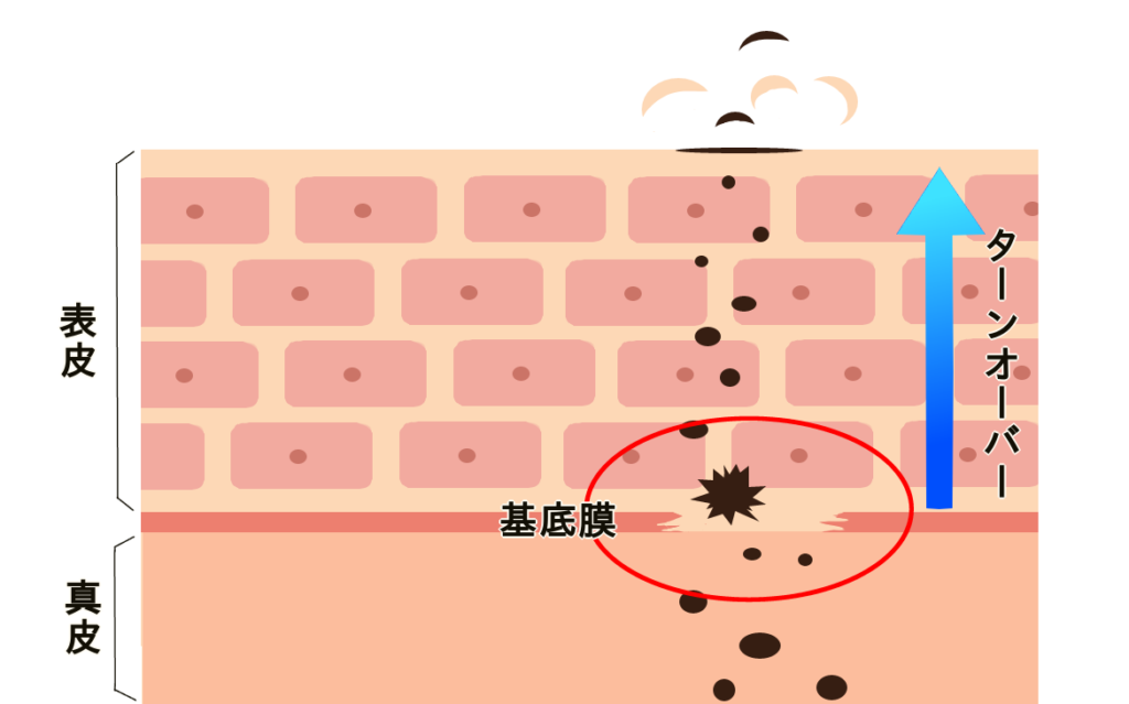 シミのイメージ２